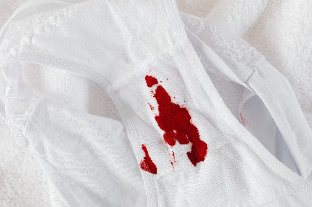 Chemise blanche avec tache d'huile et produits détachants sur table